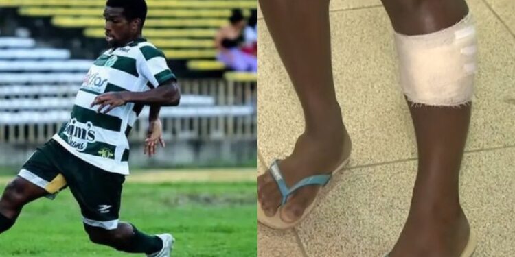 Mãe de jogador baleado por PM compara policiais e bandidos: “Não sei de quem tenho mais medo”