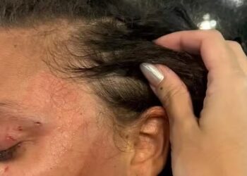 STJ nega soltura de suspeito de agredir mulher confundida com trans