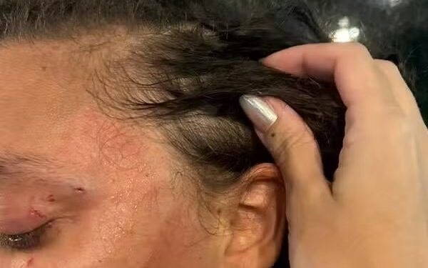 STJ nega soltura de suspeito de agredir mulher confundida com trans