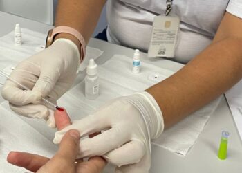 Carnaval terá postos de testagem rápida para ISTs em Salvador e no interior do estado